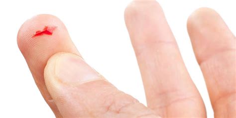 how long does a small scratch take to heal