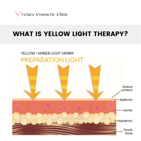 how long does a yellow light stay on