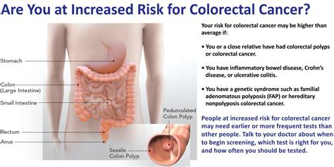 how long does colon cancer take to develop