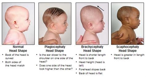 how long does it take for a baby's head to form