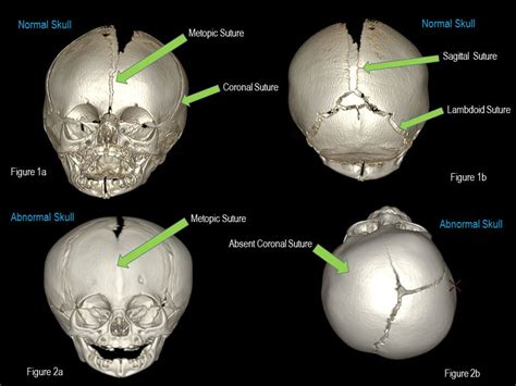 how long does it take for a baby skull to fully develop