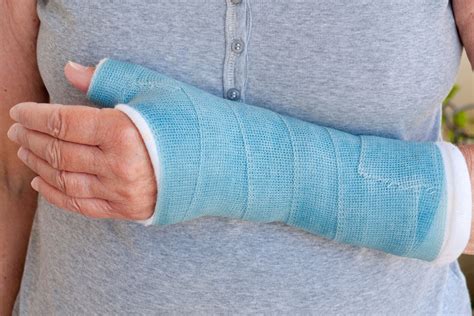 how long does it take for a broken arm to heal in a child
