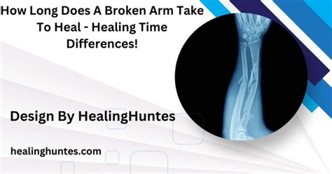 how long does it take for a broken arm to heal in kids