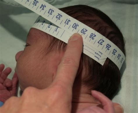 how long does it take for a newborn's head to form