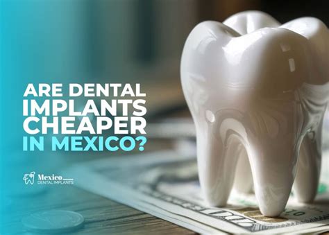how much is it to get teeth implants in mexico