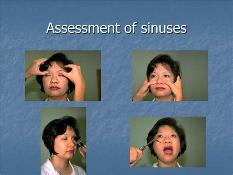 how to assess maxillary and frontal sinuses
