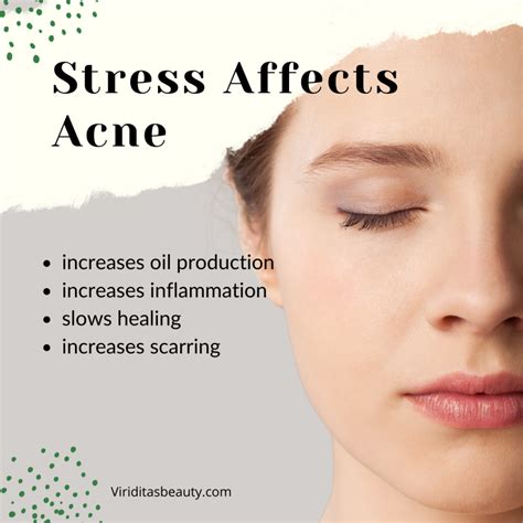 how to avoid stress acne