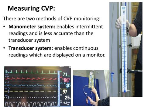 how to calculate cvp pressure