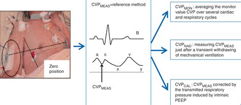 how to calculate cvp with peep