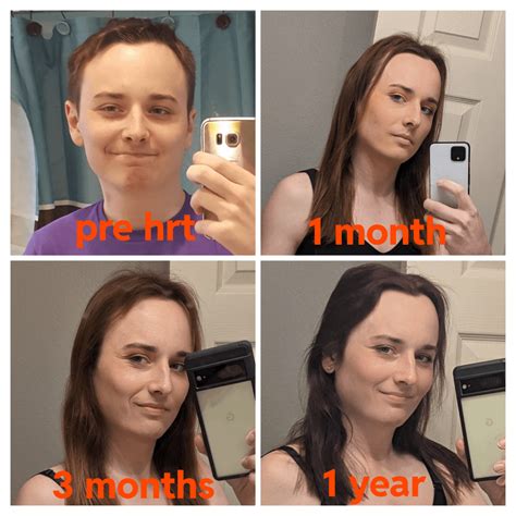 how to change age on reddit