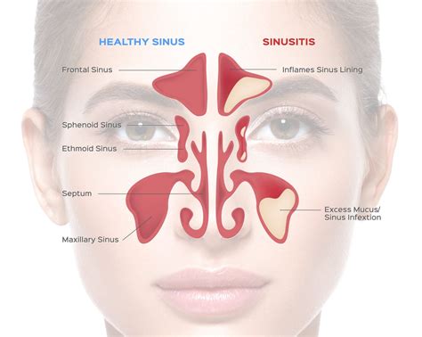 how to check maxillary sinus