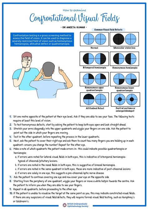 how to document visual fields