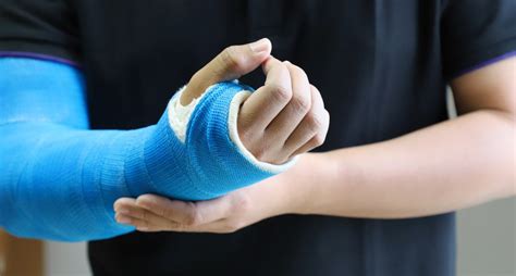 how to exercise with broken arm