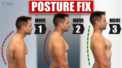 how to fix bad posture permanently