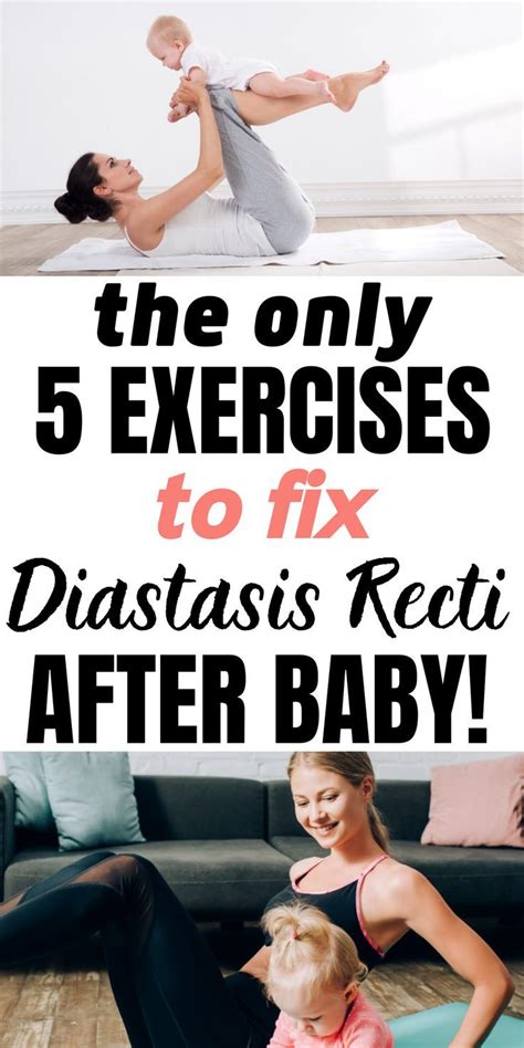 how to fix diastasis after pregnancy