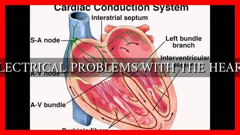 how to fix electrical problems in heart