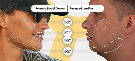 how to get more forward maxilla growth