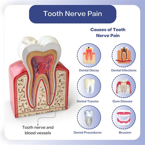how to help tooth nerve pain