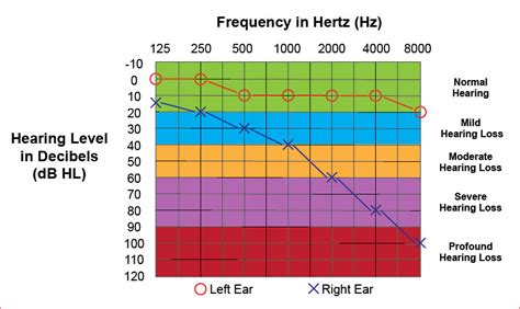 how to interpret audiometric data