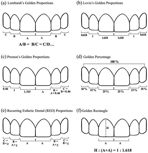 how to measure maxillary width