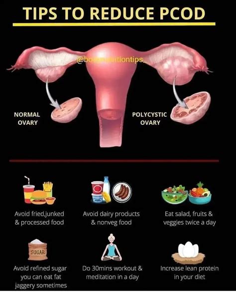how to prevent pcod problem