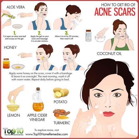 how to reduce acne scars fast