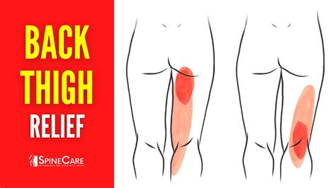 how to reduce thigh pain after exercise