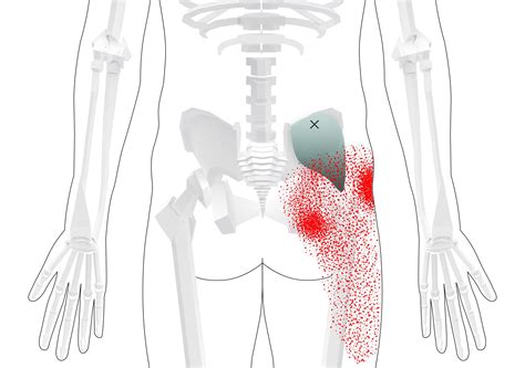 how to release trigger points in buttocks