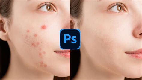 how to remove pimples on face in photoshop