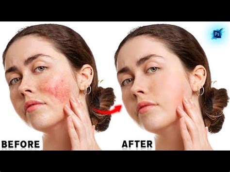 how to remove red spots from face in photoshop