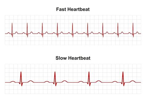 how to slow heart rate fast