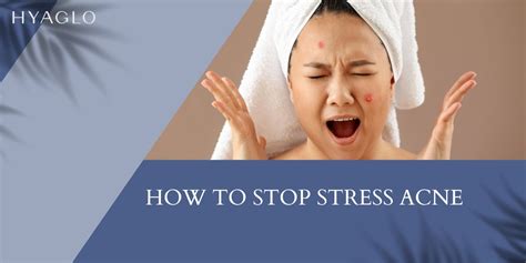 how to stop stress acne breakouts