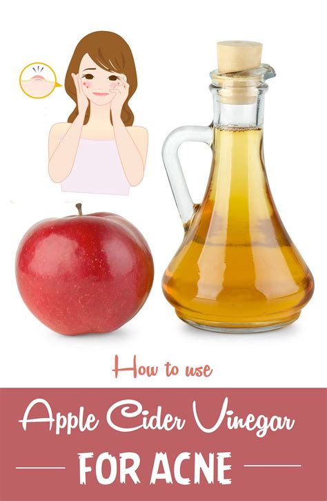 how to use apple cider vinegar for acne overnight