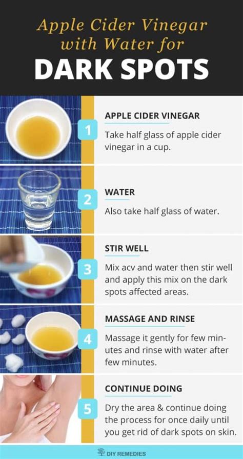 how to use apple cider vinegar to get rid of dark spots