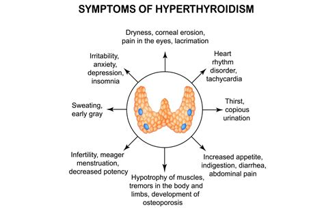 hyperthyroidism affects what body system