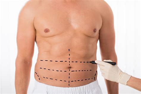 is abdominal etching dangerous