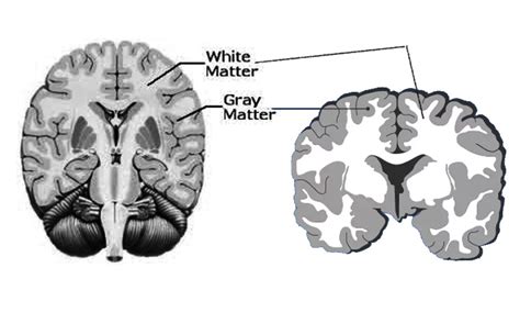 is grey matter in the brain good or bad