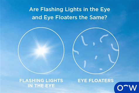 is it normal to see flashes of light in the dark