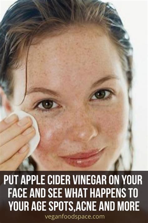 is it okay to put apple cider vinegar on face