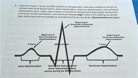 is qrs depolarization or repolarization