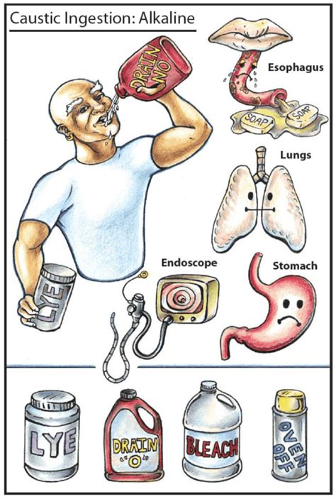 is rust toxic if ingested