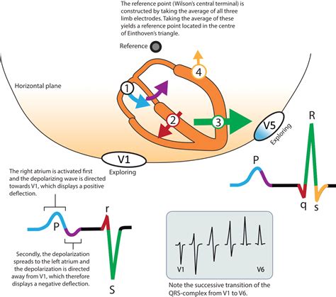 is the qrs complex depolarization or repolarization