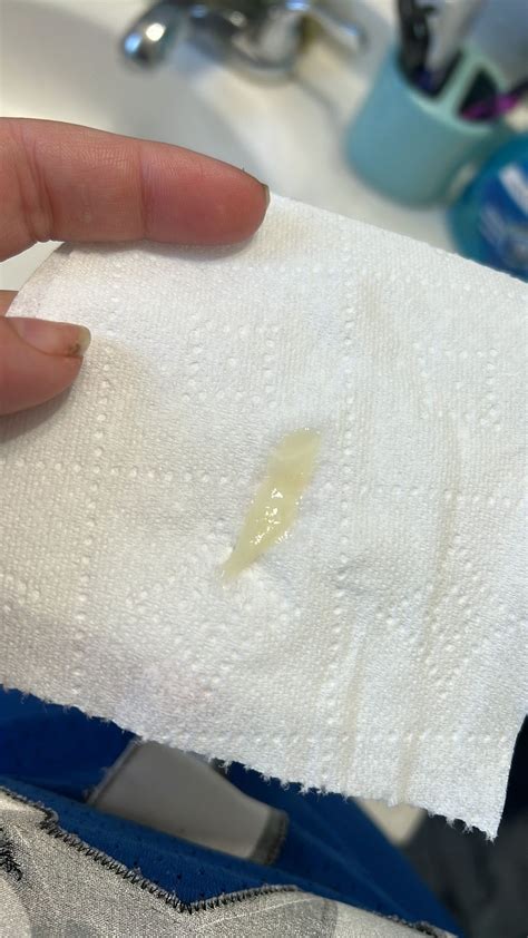 is yellow discharge normal in 3rd trimester