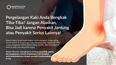 kaki bengkak