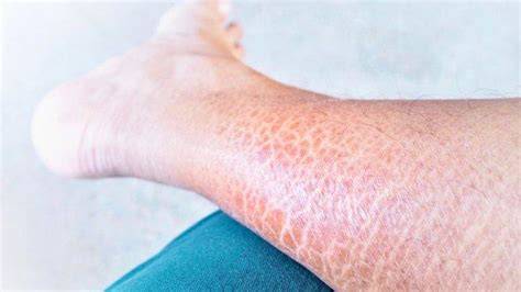 Kaki kering