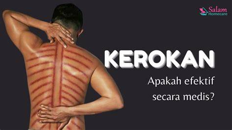 kerokan