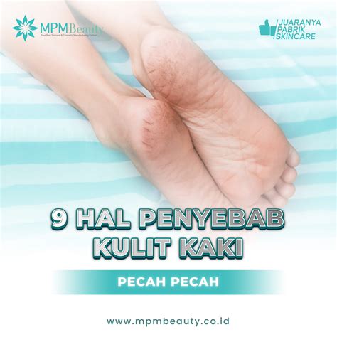 kulit pecah pecah