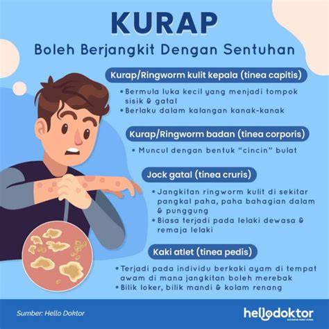 kurap di paha