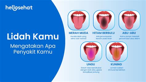 Lidah Normal