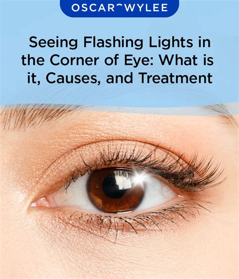 lightning type flashes in eyes